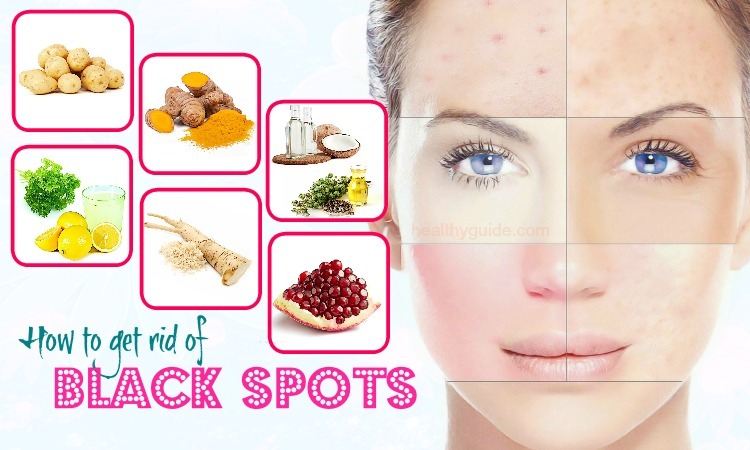 49 Tips How to Get Rid of Black Spots on Face, Nose, Neck, Legs, & Back