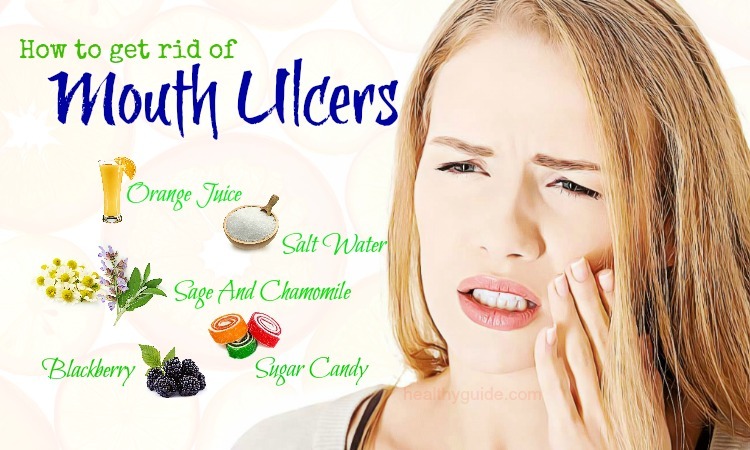 48 Tips How to Get Rid of Mouth Ulcers Pain on Throat, Gums, Tongue, & Lips