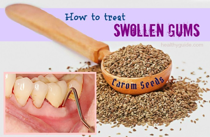 how to treat swollen gums