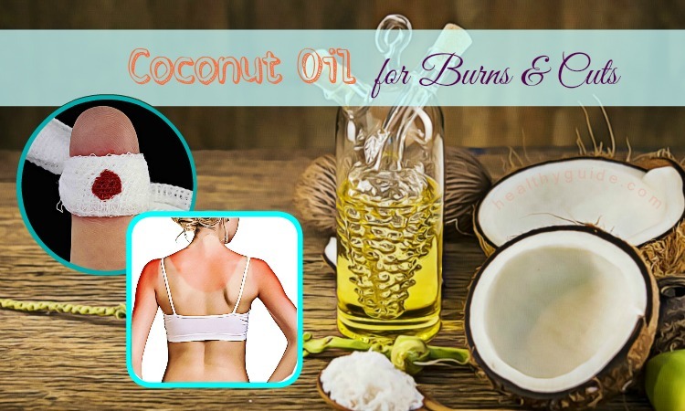Top 7 Simple Ways To Use Coconut Oil For Burns And Cuts On Face And Hands