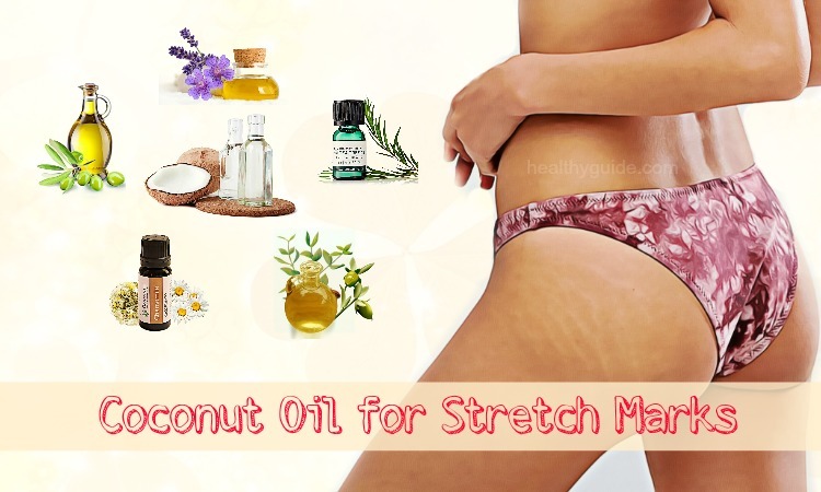 Top 27 Ways To Use Coconut Oil For Stretch Marks On Breasts During Pregnancy
