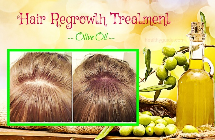 hair regrowth treatment