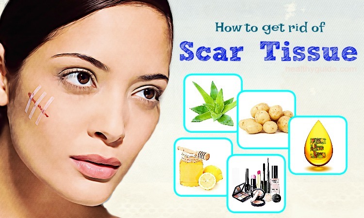 How To Get Rid Of Scar Tissue On Face And Lip- Top 28 Simple Methods