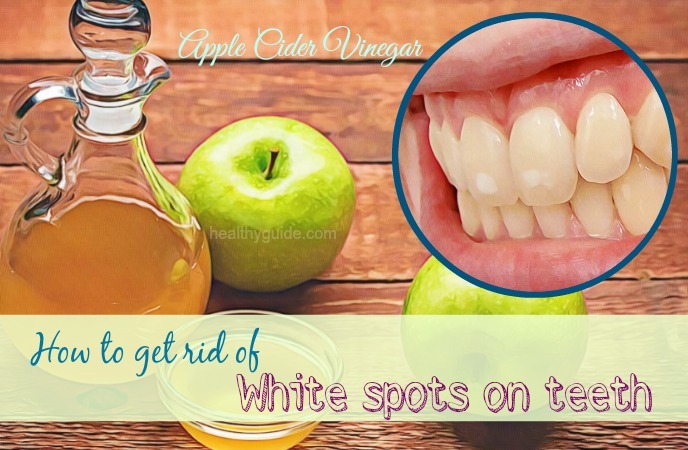 how to get rid of white spots on teeth
