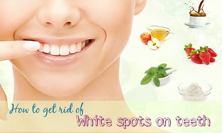 34 Tips How to Get Rid of White Spots on Teeth Fast & Naturally Overnight at Home
