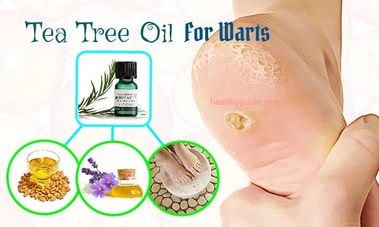 24 Ways to Use Tea Tree Oil for Warts on Face, Hand, Scalp, Neck & Finger