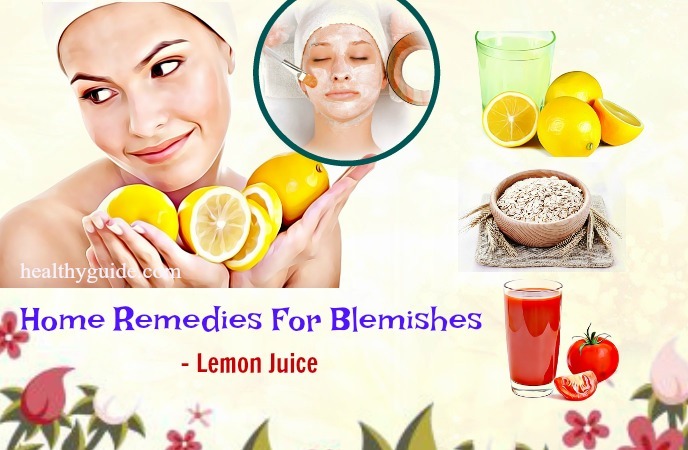 home remedies for blemishes
