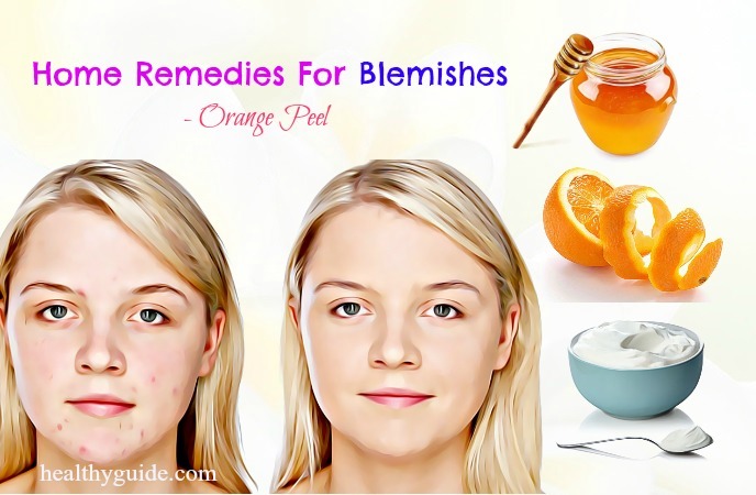 home remedies for blemishes 