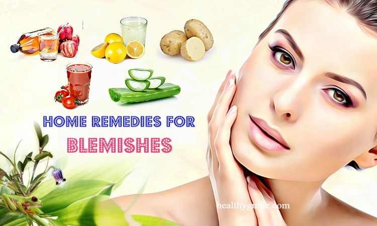 11 Natural Home Remedies for Blemishes on Face, Cheeks, Nose, & Legs