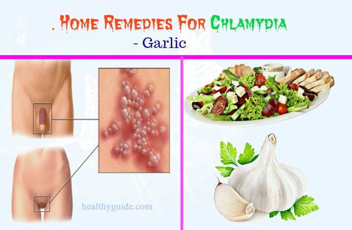 home remedies for chlamydia 