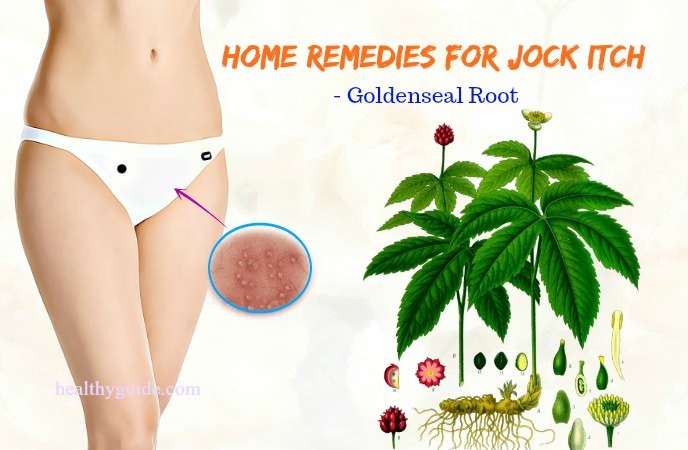 home remedies for jock itch