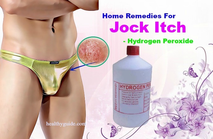 home remedies for jock itch 