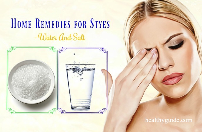 home remedies for styes 