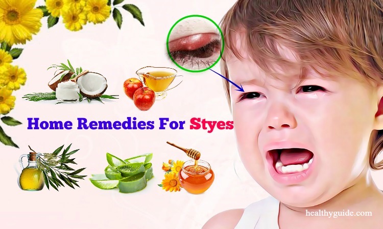 49 Home Remedies for Styes on Upper, Lower Eyelid in Babies, Toddlers, Adults