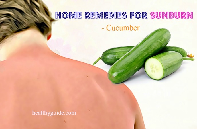 home remedies for sunburn 