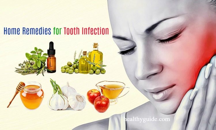 20 Best Natural Home Remedies for Tooth Infection Pain and ...