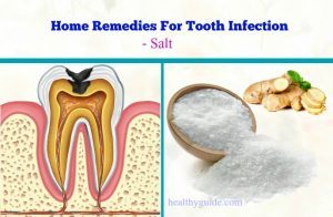 20 Best Natural Home Remedies for Tooth Infection Pain and Swelling