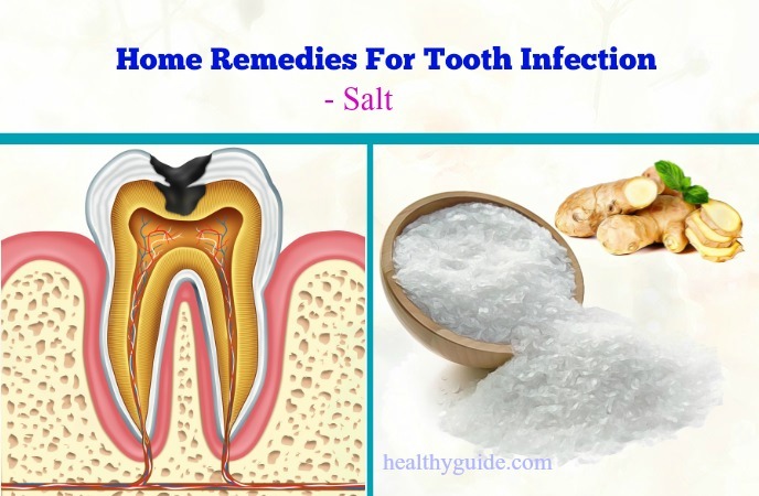 home remedies for tooth infection 