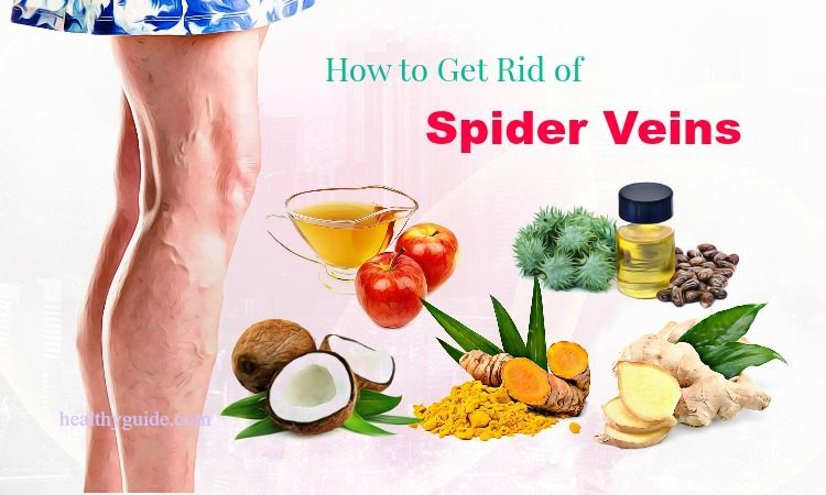 45 Tips How to Get Rid of Spider Veins on Face, Nose, Chest, Legs & Ankles