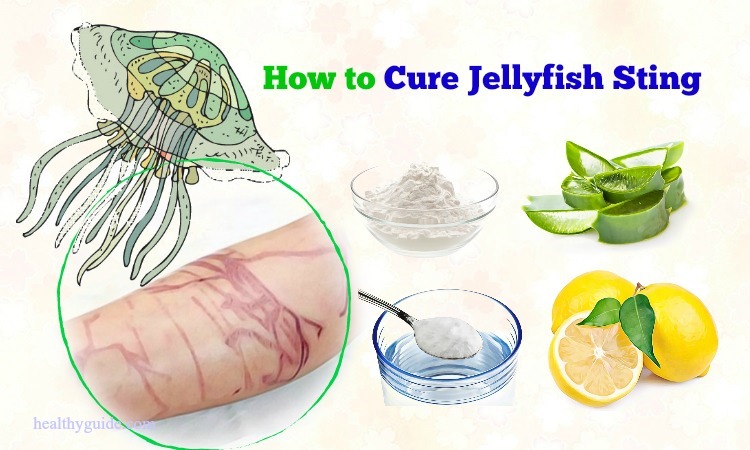 16 Tips How to Cure Jellyfish Sting Rash & Itching Naturally after a Week