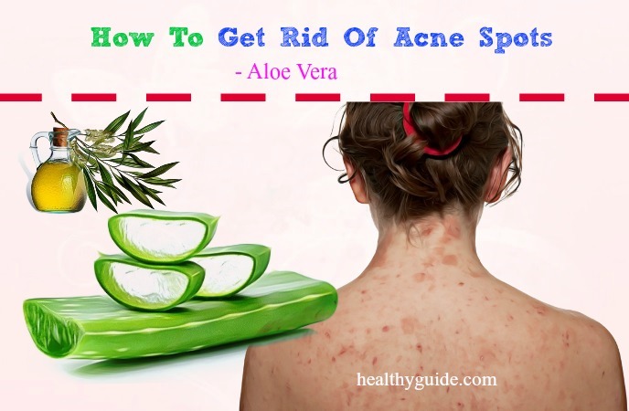 how to get rid of acne spots 