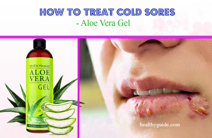 how to treat cold sores