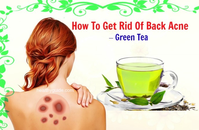 how to get rid of back acne 