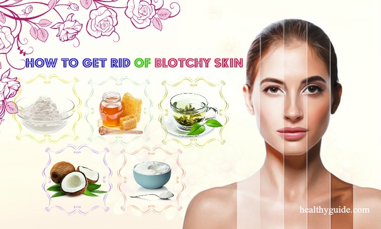 10 Tips How to Get Rid of Blotchy Skin on Arms, Legs, Back from Sunburn, Peeling