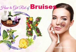 22 Tips How to Get Rid of Bruises on Lips, Face, Shins, and Hands Fast