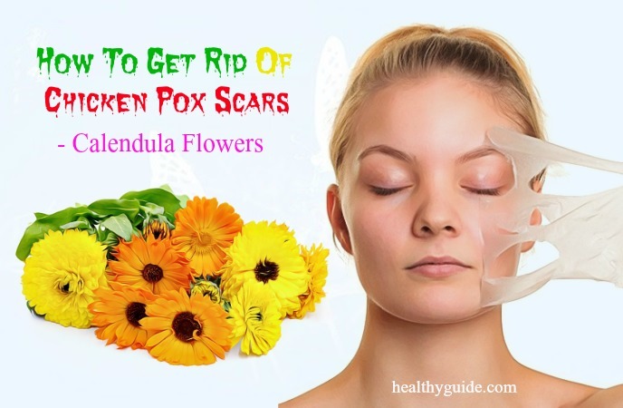 how to get rid of chicken pox scars