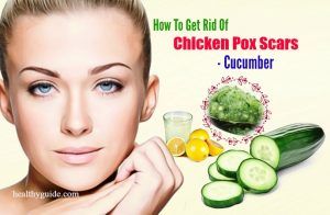how to get rid of chicken pox scars on face