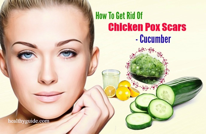 how to get rid of chicken pox scars 