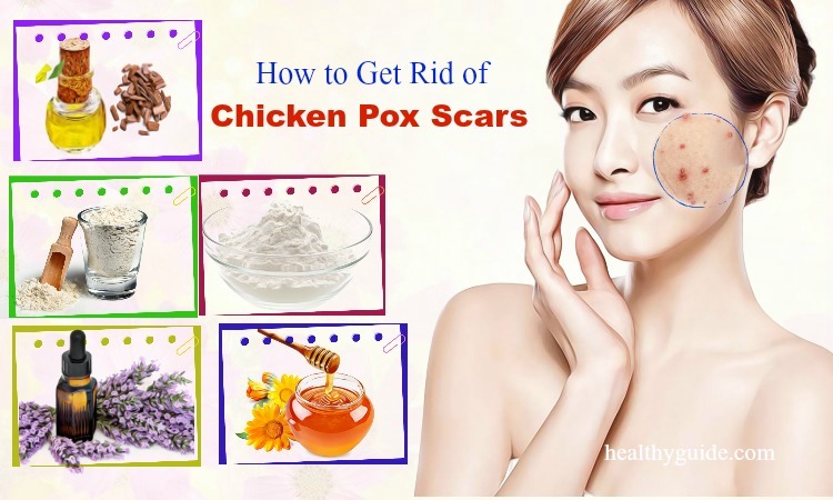 how to get rid of chicken pox scars on face