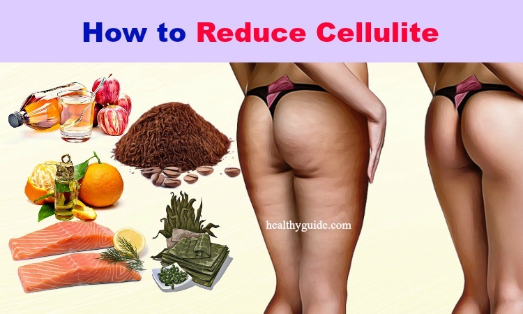 10 Tips How to Reduce Cellulite on Bum, Arms, Legs & Thighs Fast in a Month