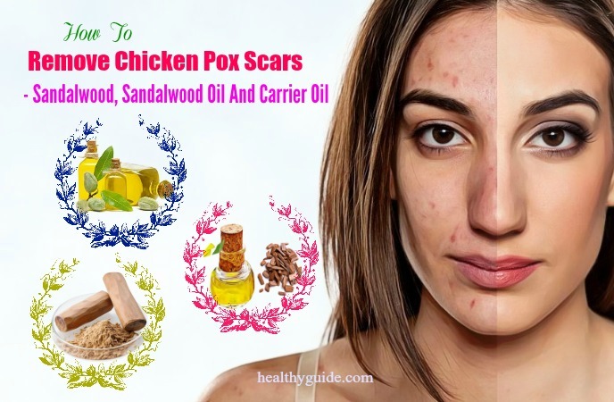 how to remove chicken pox scars 