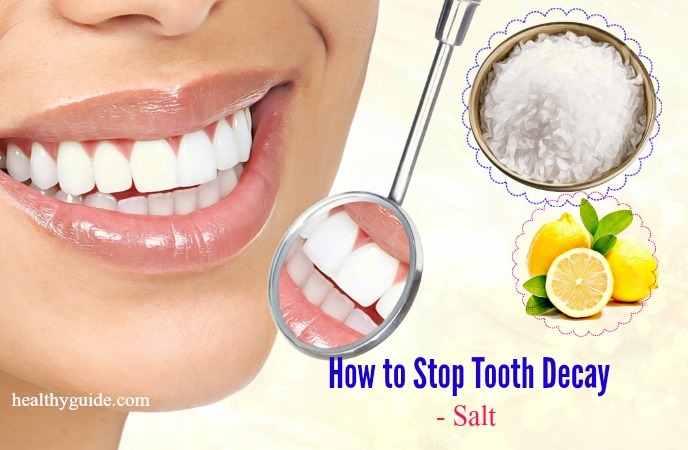 how to stop tooth decay 
