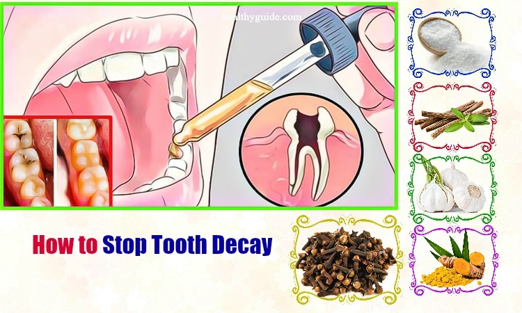 10 Tips How to Stop Tooth Decay Pain at Gum Line in Babies, Toddlers, Adults