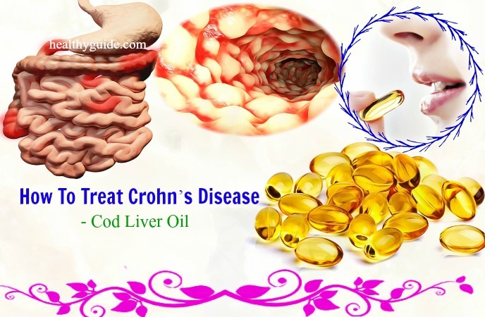 how to treat Crohn's disease 