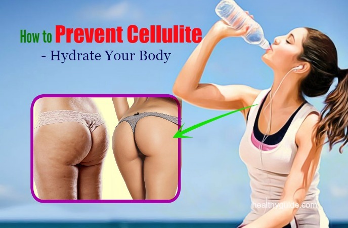 how to prevent cellulite 