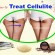 10 Tips How to Treat Cellulite on Legs, Thighs, Arms, & Buttocks at Home