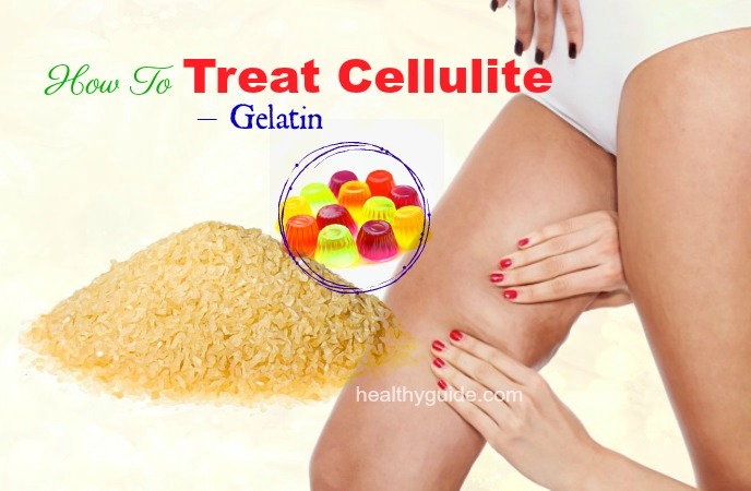 how to treat cellulite 