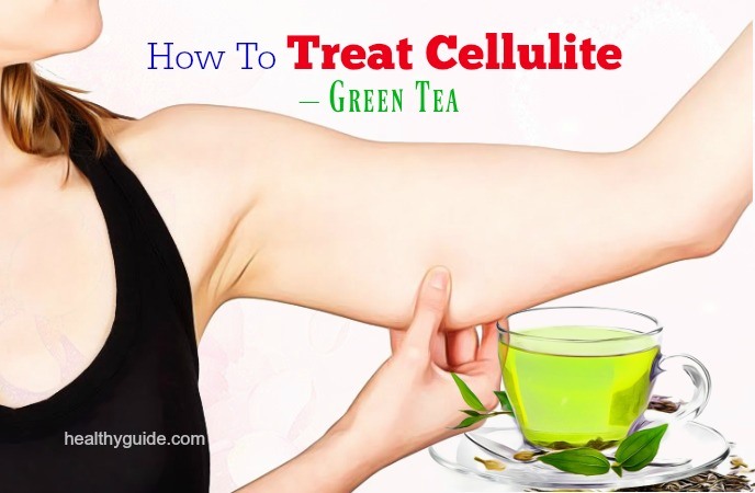 how to treat cellulite 