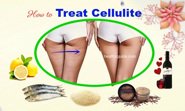 10 Tips How to Treat Cellulite on Legs, Thighs, Arms, & Buttocks at Home
