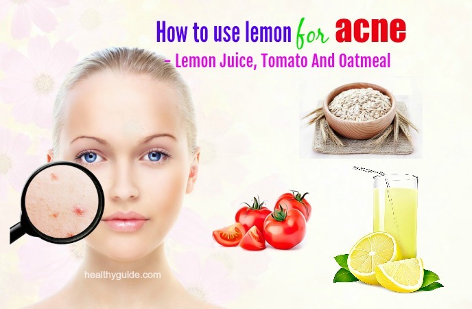 how to use lemon for acne 