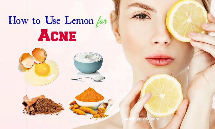 30 Tips How to Use Lemon for Acne and Pimples Scars, Spots Removal Overnight