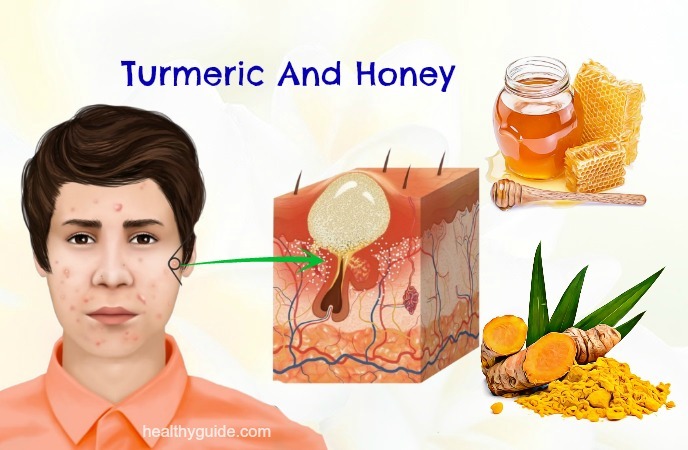 how to use turmeric for acne