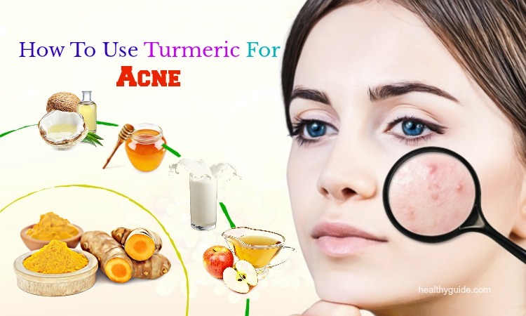 Tips How To Use Turmeric For Acne Scars, Spots And Pimple Treatment