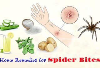 13 Natural Home Remedies for Spider Bites on Arms, Legs, Ankle, & Eyelid