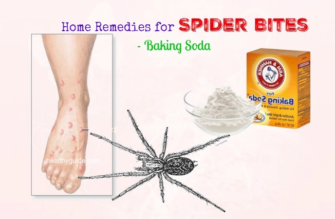 home remedies for spider bites