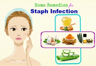 14 Home Remedies for Staph Infection Pain on Face, Scalp, Buttocks, & in Nose